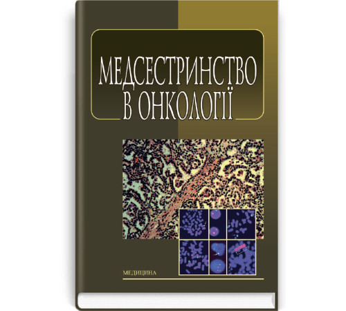 Медсестринство в онкології. Л. М. Ковальчук