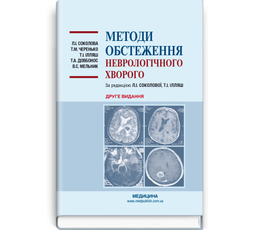 Медицина Медицина Методи обстеження неврологічного хворого Л.І. Соколова, Т.М. Черенько, Т.І. Ілляш та ін за редакцією Л.І. Соколової, Т.І. Ілляш Медицина Медицина Методи обстеження неврологічного хворого Л.І. Соколова, Т.М. Черенько, Т.І. Ілляш та ін за редакцією Л.І. Соколової, Т.І. Ілляш