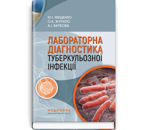 Медицина Медицина Лабораторна діагностика туберкульозної інфекції | Ю.І. Фещенко, О.А. Журило, А.І. Барбова Медицина Медицина Лабораторна діагностика туберкульозної інфекції | Ю.І. Фещенко, О.А. Журило, А.І. Барбова